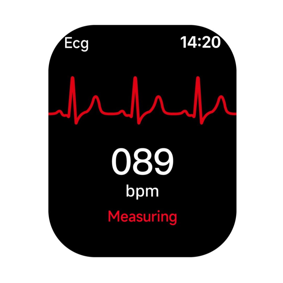Smartwatch K4G Ultra με SIM 4G - Βιντεοκλήσεις, AI Assistant και Παρακολούθηση Υγείας